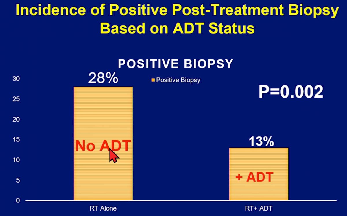 ASTRO 2022: Superior Post-Treatment Biopsy Outcomes With High Dose SBRT ...